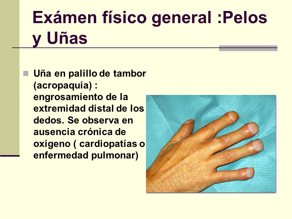 Las manchas de pigmento sobre la persona de la máscara de la mostaza